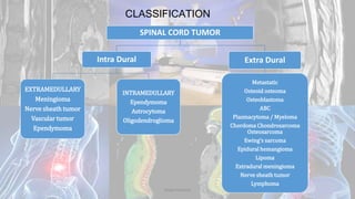 CLASSIFICATION
SPINAL CORD TUMOR
Intra Dural
EXTRAMEDULLARY
Meningioma
Nerve sheath tumor
Vascular tumor
Ependymoma
INTRAMEDULLARY
Ependymoma
Astrocytoma
Oligodendroglioma
Extra Dural
Metastatic
Osteoid osteoma
Osteoblastoma
ABC
Plasmacytoma / Myeloma
Chordoma Chondrosarcoma
Osteosarcoma
Ewing’s sarcoma
Epidural hemangioma
Lipoma
Extradural meningioma
Nerve sheath tumor
Lymphoma
Dodul Mondal
 