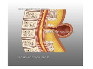Spinal Defet SPINAL DEFECT of baby when they are born | PPTX