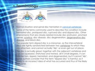 • Terminology




•   Normal situation and spinal disc herniation in cervical vertebrae.
•   Some of the terms commonly used to describe the condition include
    herniated disc, prolapsed disc, ruptured disc and slipped disc. Other
    phenomena that are closely related include disc protrusion, pinched
    nerves, sciatica, disc disease, disc degeneration, degenerative disc
    disease, and black disc.
•   The popular term slipped disc is a misnomer, as the intervertebral
    discs are tightly sandwiched between two vertebrae to which they
    are attached, and cannot actually "slip", or even get out of place.
•   The disc is actually grown together with the adjacent vertebrae and
    can be squeezed, stretched and twisted, all in small degrees. It can
    also be torn, ripped, herniated, and degenerated, but it cannot "slip".
    Some authors consider that the term "slipped disc" is harmful, as it
    leads to an incorrect idea of what has occurred and thus of the likely
    outcome.
 