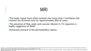 MRI
• The hyper signal most often extends over more than 2 vertebrae and
involves the terminal cone for approximately 80% of cases.
• The presence of flow voids and vascular dilation in T2 sequence is
highly suggestive of DAVF.
• Enhanced contrast of the perimedullary spaces.
Luetmer PH, Lane JI, Gilbertson JR, Bernstein MA, Huston J, et al. (2005) Preangiographic evaluation of spinal dural arteriovenous fistulas with elliptic centric contrast-enhanced MR Angiography and effect on
radiation dose and volume of iodinated contrast material. AJNR Am J Neuroradiol. 26: 711-718.
Hurst RW, Grossman RI (2000) Peripheral spinal cord hypointensity on J Spine ISSN: 2165-7939 JSP, an open access journal T2-weighted MR images: a reliable imaging sign of venous hypertensive myelopathy.
 