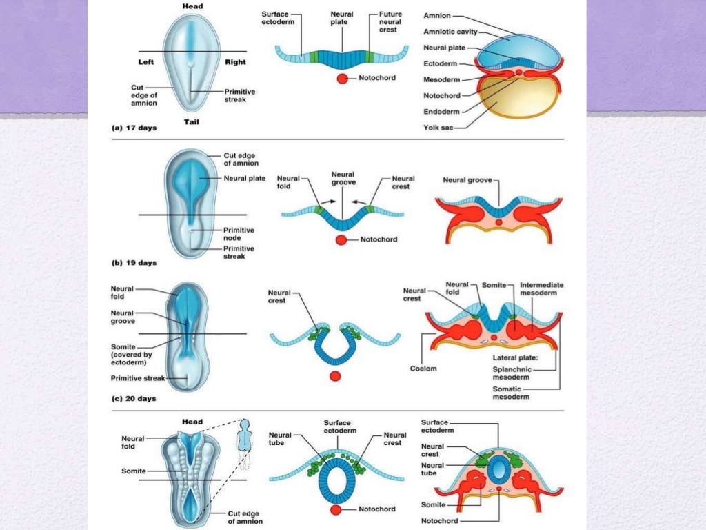 Spinal dysraphism