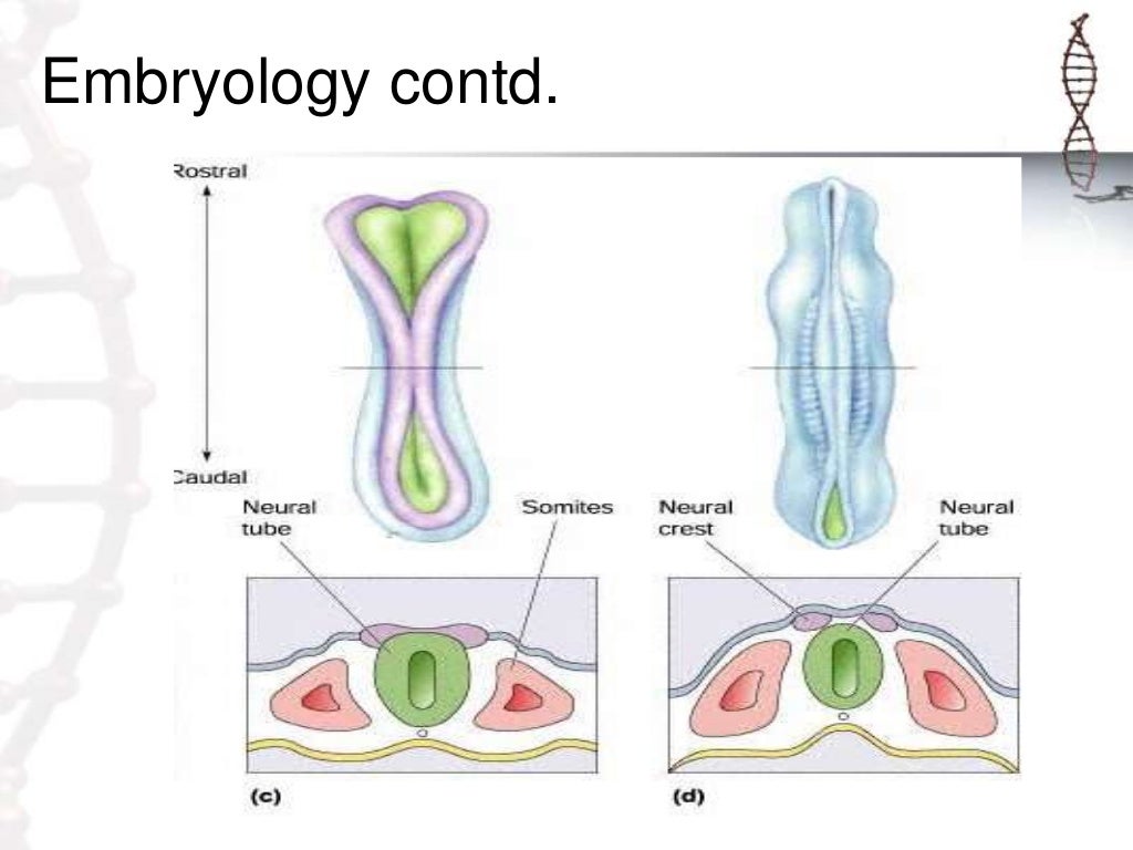 Spinal dysraphism and its management