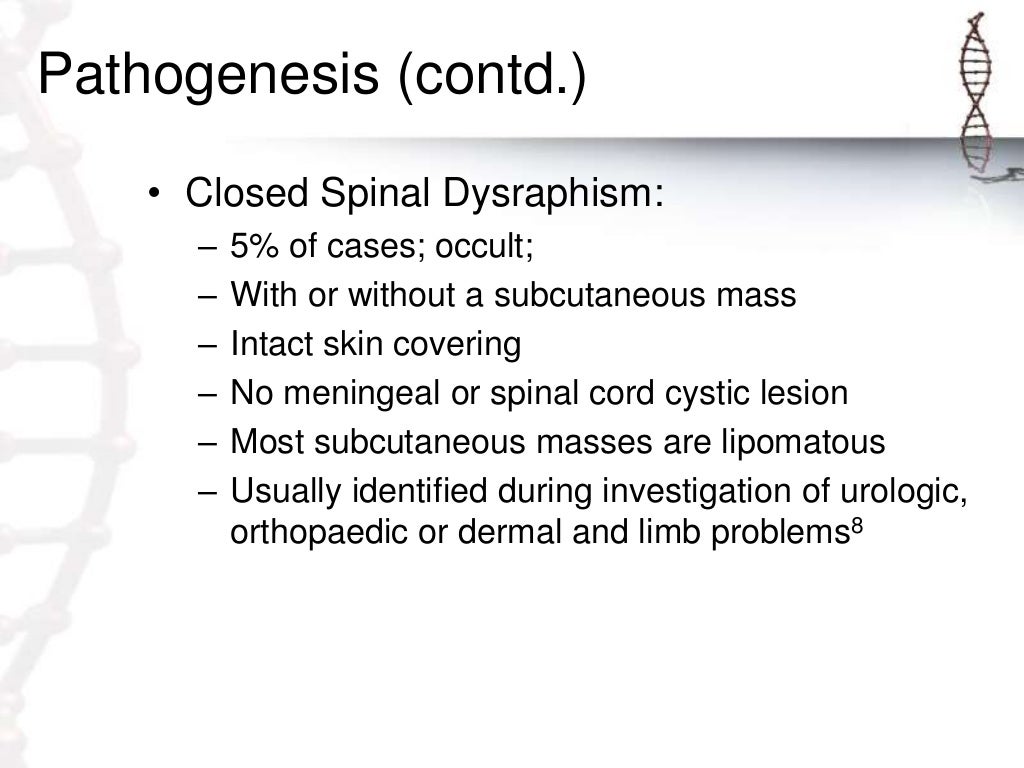 Spinal dysraphism and its management