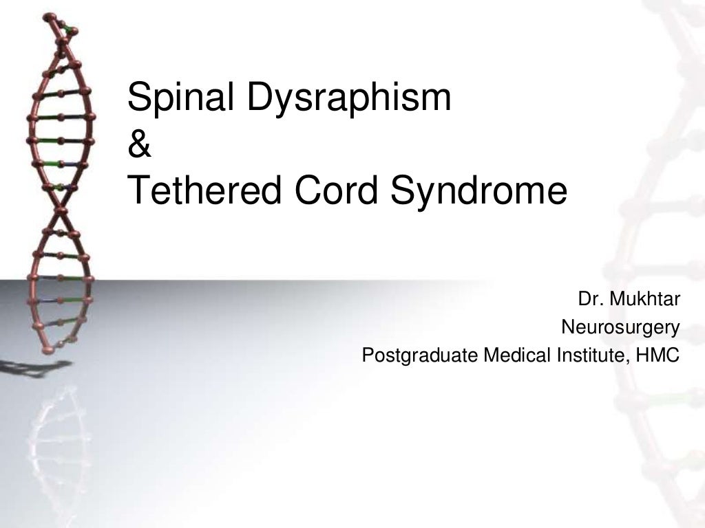 Spinal dysraphism and its management