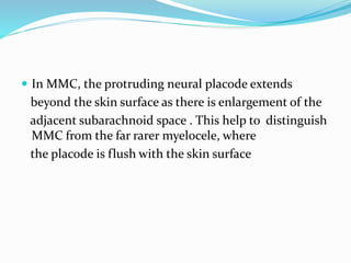  In MMC, the protruding neural placode extends
beyond the skin surface as there is enlargement of the
adjacent subarachnoid space . This help to distinguish
MMC from the far rarer myelocele, where
the placode is flush with the skin surface
 