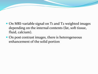  On MRI-variable signal on T1 and T2 weighted images
depending on the internal contents (fat, soft tissue,
fluid, calcium).
 On post contrast images, there is heterogeneous
enhancement of the solid portion
 