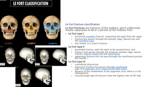 Fort Classification Spinal Fractures.pptx