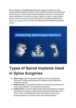 Spinal implants are medically-designed devices surgeons typically use to treat
several conditions related to the spine. These conditions range across spinal injuries,
spinal fractures, or other medical conditions attributed to the spine. The purpose of
spinal implantations in the body is to support, stabilize, correct, or make the spine
structure mobile. The major aim of spinal implants is to facilitate and allow spine
fusion. Spine implants are one of the most important tools accredited during spinal
surgery.
Types of Spinal Implants Used
in Spine Surgeries
■ Spinal Cages: Spinal Cages play a significant role in the spinal fusion
procedure. It creates space between the vertebrae and promotes fusion
through bone growth.
■ Pedicle Screws: These Pedicle Screws are inserted into the vertebrae and
act as major stabilizers in the spinal fusion procedures.
■ Artificial Discs: One of the biggest spinal implant technological innovations,
artificial discs are utilized to replace degenerated intervertebral discs in the
spine. The aim of implanting these discs into a patient’s body during a
surgical procedure is to maintain motion at the affected segment.
 