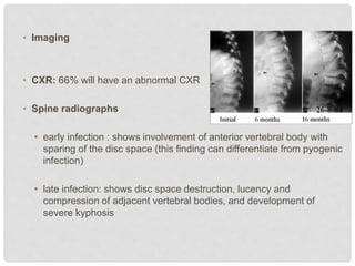 • Imaging
• CXR: 66% will have an abnormal CXR
• Spine radiographs
• early infection : shows involvement of anterior vertebral body with
sparing of the disc space (this finding can differentiate from pyogenic
infection)
• late infection: shows disc space destruction, lucency and
compression of adjacent vertebral bodies, and development of
severe kyphosis
 