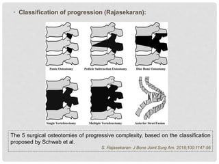 • Classification of progression (Rajasekaran):
The 5 surgical osteotomies of progressive complexity, based on the classification
proposed by Schwab et al.
S. Rajasekaran- J Bone Joint Surg Am. 2018;100:1147-56
 