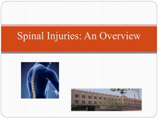 Spinal Injuries: An Overview
 