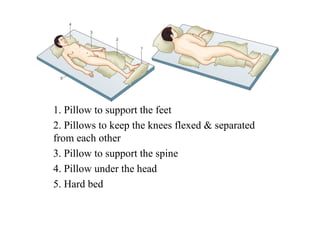 1. Pillow to support the feet
2. Pillows to keep the knees flexed & separated
from each other
3. Pillow to support the spine
4. Pillow under the head
5. Hard bed
 