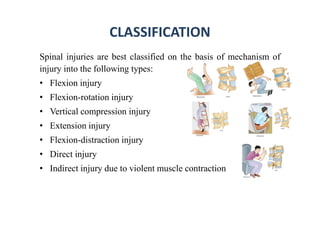 CLASSIFICATION
Spinal injuries are best classified on the basis of mechanism of
injury into the following types:
• Flexion injury
• Flexion-rotation injury
• Vertical compression injury
• Extension injury
• Flexion-distraction injury
• Direct injury
• Indirect injury due to violent muscle contraction
 