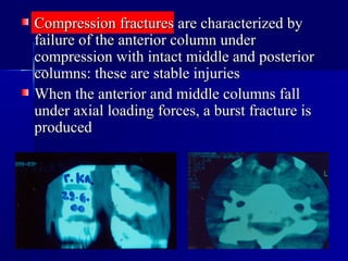 Spinal injuries 2009 | PPT