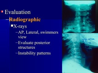 Twining Method Radiography Spinal injuries 2009 | PPT