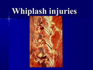 WWhhiippllaasshh iinnjjuurriieess 
 