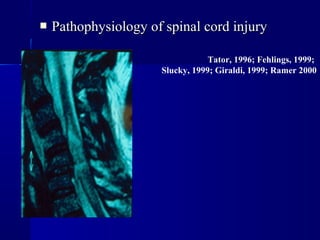  Pathophysiology ooff ssppiinnaall ccoorrdd iinnjjuurryy 
Tator, 1996; Fehlings, 1999; 
Slucky, 1999; Giraldi, 1999; Ramer 2000 
 