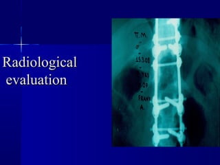 RRaaddiioollooggiiccaall 
eevvaalluuaattiioonn 
 