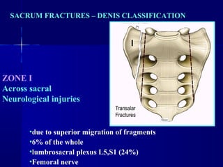 SACRUM FRACTURES –– DDEENNIISS CCLLAASSSSIIFFIICCAATTIIOONN 
ZONE I 
Across sacral 
Neurological injuries 
•due to superior migration of fragments 
•6% of the whole 
•lumbrosacral plexus L5,S1 (24%) 
•Femoral nerve 
 
