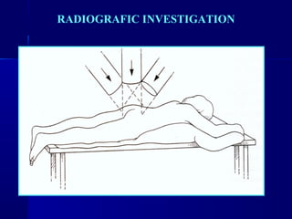 RADIOGRAFIC INVESTIGATION 
 