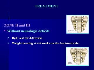 TREATMENT 
ZONE II and III 
• Without neurologic deficits 
• Bed rest for 4-8 weeks 
• Weight bearing at 4-8 weeks on the fractured side 
 