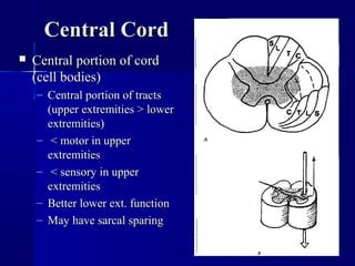 CCeennttrraall CCoorrdd 
 CCeennttrraall ppoorrttiioonn ooff ccoorrdd 
((cceellll bbooddiieess)) 
– CCeennttrraall ppoorrttiioonn ooff ttrraaccttss 
((uuppppeerr eexxttrreemmiittiieess >> lloowweerr 
eexxttrreemmiittiieess)) 
– << mmoottoorr iinn uuppppeerr 
eexxttrreemmiittiieess 
– << sseennssoorryy iinn uuppppeerr 
eexxttrreemmiittiieess 
– BBeetttteerr lloowweerr eexxtt.. ffuunnccttiioonn 
– MMaayy hhaavvee ssaarrccaall ssppaarriinngg 
 