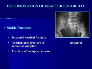 DETERMINATION OF FRACTURE STABILITY 
• Stable fractures 
• Impacted vertical fracture 
• Nondisplaced fracture of posterior 
sacroiliac complex 
• Fracture of the upper sacrum 
 