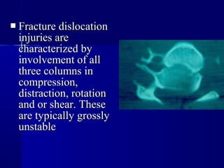  FFrraaccttuurree ddiissllooccaattiioonn 
iinnjjuurriieess aarree 
cchhaarraacctteerriizzeedd bbyy 
iinnvvoollvveemmeenntt ooff aallll 
tthhrreeee ccoolluummnnss iinn 
ccoommpprreessssiioonn,, 
ddiissttrraaccttiioonn,, rroottaattiioonn 
aanndd oorr sshheeaarr.. TThheessee 
aarree ttyyppiiccaallllyy ggrroossssllyy 
uunnssttaabbllee 
 