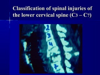 Classification ooff ssppiinnaall iinnjjuurriieess ooff 
tthhee lloowweerr cceerrvviiccaall ssppiinnee ((CC33 –– CC77)) 
 