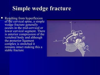 SSiimmppllee wweeddggee ffrraaccttuurree 
 RReessuullttiinngg ffrroomm hhyyppeerrfflleexxiioonn 
ooff tthhee cceerrvviiccaall ssppiinnee,, aa ssiimmppllee 
wweeddggee ffrraaccttuurree ggeenneerraallllyy 
ooccccuurrss iinn tthhee mmiidd--cceerrvviiccaall oorr 
lloowweerr cceerrvviiccaall sseeggmmeenntt.. TThheerree 
iiss aanntteerriioorr ccoommpprreessssiioonn ooff tthhee 
vveerrtteebbrraall bbooddyy aanndd aalltthhoouugghh 
tthhee ppoosstteerriioorr lliiggaammeenntt 
ccoommpplleexx iiss ssttrreettcchheedd iitt 
rreemmaaiinnss iinnttaacctt mmaakkiinngg tthhiiss aa 
ssttaabbllee ffrraaccttuurree 
 