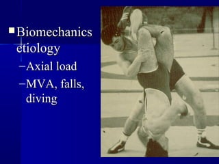 BBii oommeecchhaanniiccss 
eettiioollooggyy 
–AAxxiiaall llooaadd 
–MMVVAA,, ffaallllss,, 
ddiivviinngg 
 