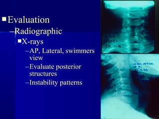 EEvvaalluuaattiioonn 
–RRaaddiiooggrraapphhiicc 
XX--rraayyss 
–AAPP,, LLaatteerraall,, sswwiimmmmeerrss 
vviieeww 
–EEvvaalluuaattee ppoosstteerriioorr 
ssttrruuccttuurreess 
–IInnssttaabbiilliittyy ppaatttteerrnnss 
 