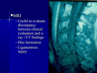 MMRRII 
–UUsseeffuull ttoo eevvaalluuaattee 
ddiissccrreeppaannccyy 
bbeettwweeeenn cclliinniiccaall 
eevvaalluuaattiioonn aanndd xx-- 
rraayy // CCTT ffiinnddiinnggss 
–DDiisscc hheerrnniiaattiioonn 
–LLiiggaammeennttoouuss 
iinnjjuurryy 
 
