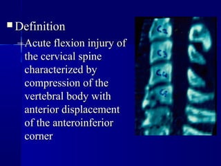 DDeeffiinniittiioonn 
–AAccuuttee fflleexxiioonn iinnjjuurryy ooff 
tthhee cceerrvviiccaall ssppiinnee 
cchhaarraacctteerriizzeedd bbyy 
ccoommpprreessssiioonn ooff tthhee 
vveerrtteebbrraall bbooddyy wwiitthh 
aanntteerriioorr ddiissppllaacceemmeenntt 
ooff tthhee aanntteerrooiinnffeerriioorr 
ccoorrnneerr 
 