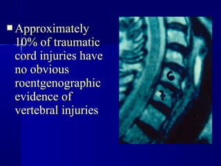 AApppprrooxxiimmaatteellyy 
1100%% ooff ttrraauummaattiicc 
ccoorrdd iinnjjuurriieess hhaavvee 
nnoo oobbvviioouuss 
rrooeennttggeennοοggrraapphhiicc 
eevviiddeennccee ooff 
vveerrtteebbrraall iinnjjuurriieess 
 