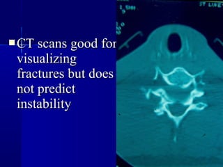 CCTT ssccaannss ggoooodd ffoorr 
vviissuuaalliizziinngg 
ffrraaccttuurreess bbuutt ddooeess 
nnoott pprreeddiicctt 
iinnssttaabbiilliittyy 
 