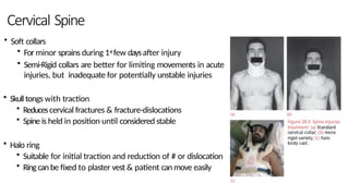 SPINAL INJURies S yr519 24420200987.pptx