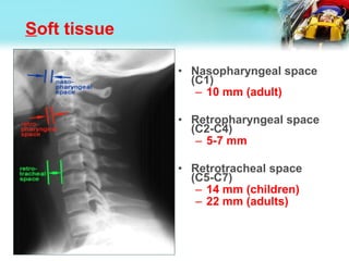 Soft tissue
• Nasopharyngeal space
(C1)
– 10 mm (adult)
• Retropharyngeal space
(C2-C4)
– 5-7 mm
• Retrotracheal space
(C5-C7)
– 14 mm (children)
– 22 mm (adults)
 