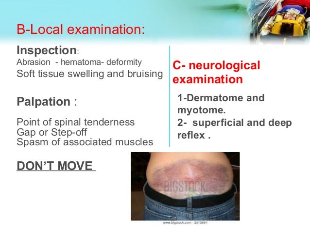 ‫Spinal injury