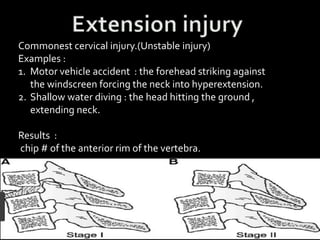 Spinal fractures (injury) | PPTX