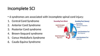 Incomplete SCI
• 6 syndromes are associated with incomplete spinal cord injury:
1. Central Cord Syndrome
2. Anterior Cord Syndrome
3. Posterior Cord syndrome
4. Brown-Sequard syndrome
5. Conus Medullaris Syndrome
6. Cauda Equina Syndrome
 