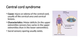Central cord syndrome
• Cause: Injury or edema of the central cord,
usually of the cervical area and cervical
lesions.
• Characteristics: Motor deficits (in the upper
extremities sensory loss varies in the upper
extremities than in the lower extremities).
• Sacral sensory sparing usually exists.
 