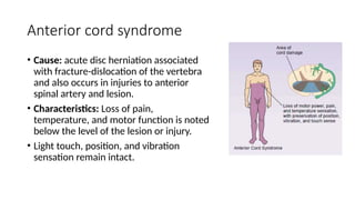 Anterior cord syndrome
• Cause: acute disc herniation associated
with fracture-dislocation of the vertebra
and also occurs in injuries to anterior
spinal artery and lesion.
• Characteristics: Loss of pain,
temperature, and motor function is noted
below the level of the lesion or injury.
• Light touch, position, and vibration
sensation remain intact.
 