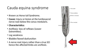 Cauda equina syndrome
• Known as Horse tail Syndrome.
• Cause: Injury or lesion at the lumbosacral
nerve root below the conus medularis.
• Characteristics:
• Areflexia- loss of reflexes (Lower
Extremities).
• Leg weakness
• Bladder/bowel dysfunction
• A nerve root injury rather than a true SCI
hence the affected limbs are areflexic.
 