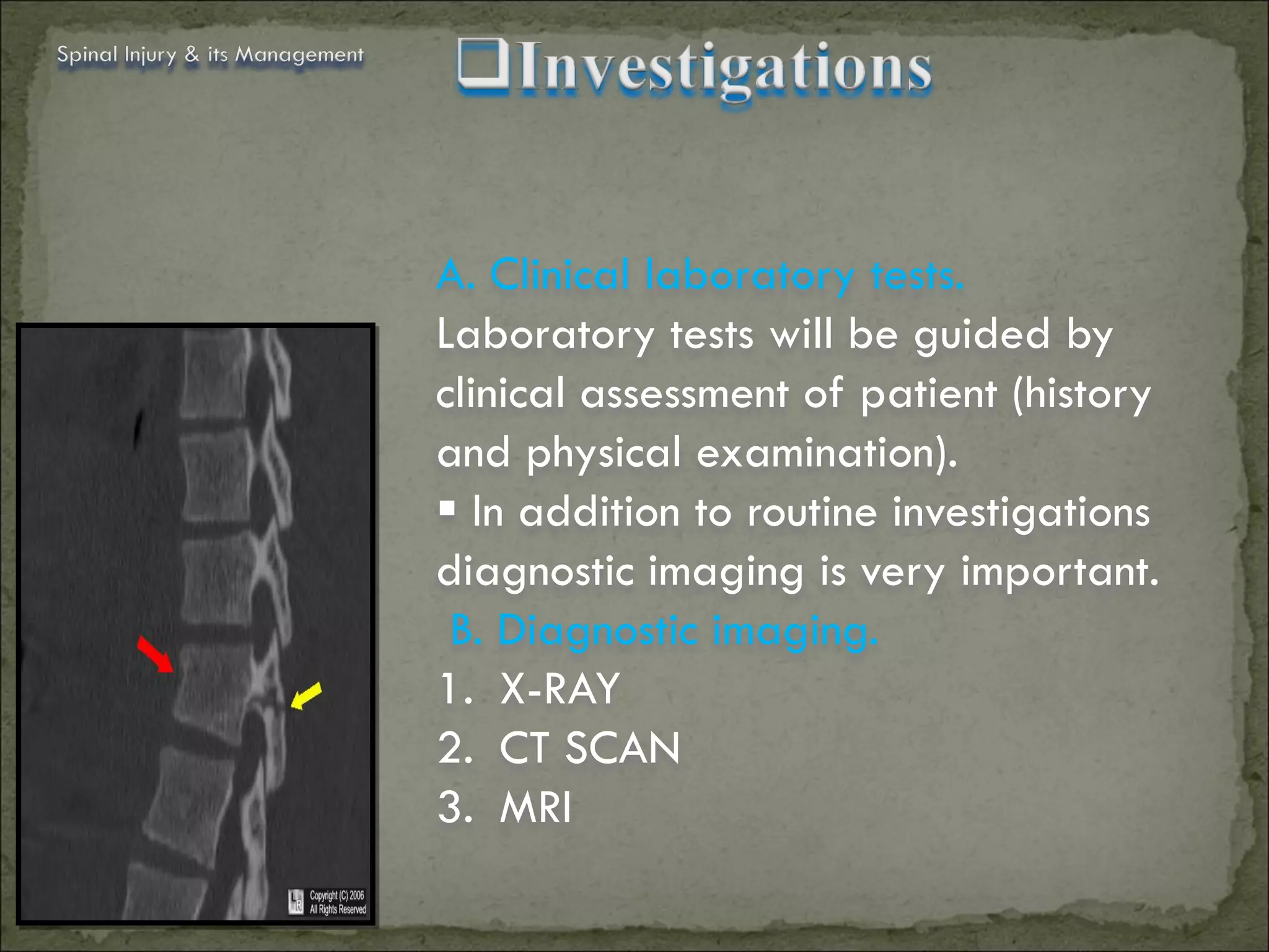 Spinal Injury & its Management




                                 A. Clinical laboratory tests.
                                 Laboratory tests will be guided by
                                 clinical assessment of patient (history
                                 and physical examination).
                                  In addition to routine investigations
                                 diagnostic imaging is very important.
                                  B. Diagnostic imaging.
                                 1. X-RAY
                                 2. CT SCAN
                                 3. MRI
 