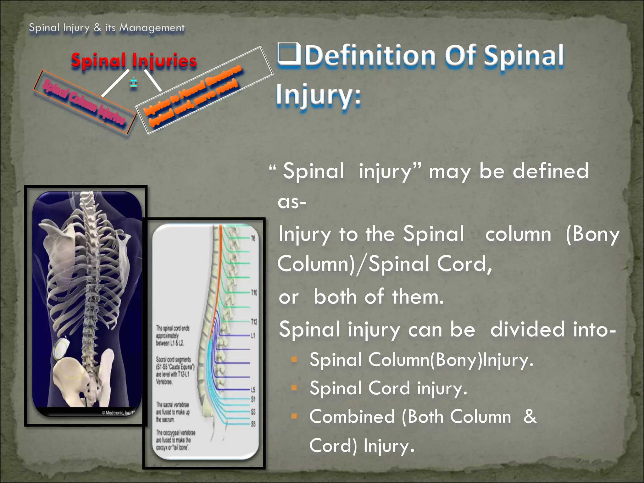 Spinal Injury & its Management

        Spinal Injuries          Definition Of Spinal
                                 Injury:

                                 “ Spinal injury” may be defined
                                 as-
                                 Injury to the Spinal column (Bony
                                 Column)/Spinal Cord,
                                 or both of them.
                                 Spinal injury can be divided into-
                                    Spinal Column(Bony)Injury.
                                    Spinal Cord injury.
                                    Combined (Both Column &
                                     Cord) Injury.
 