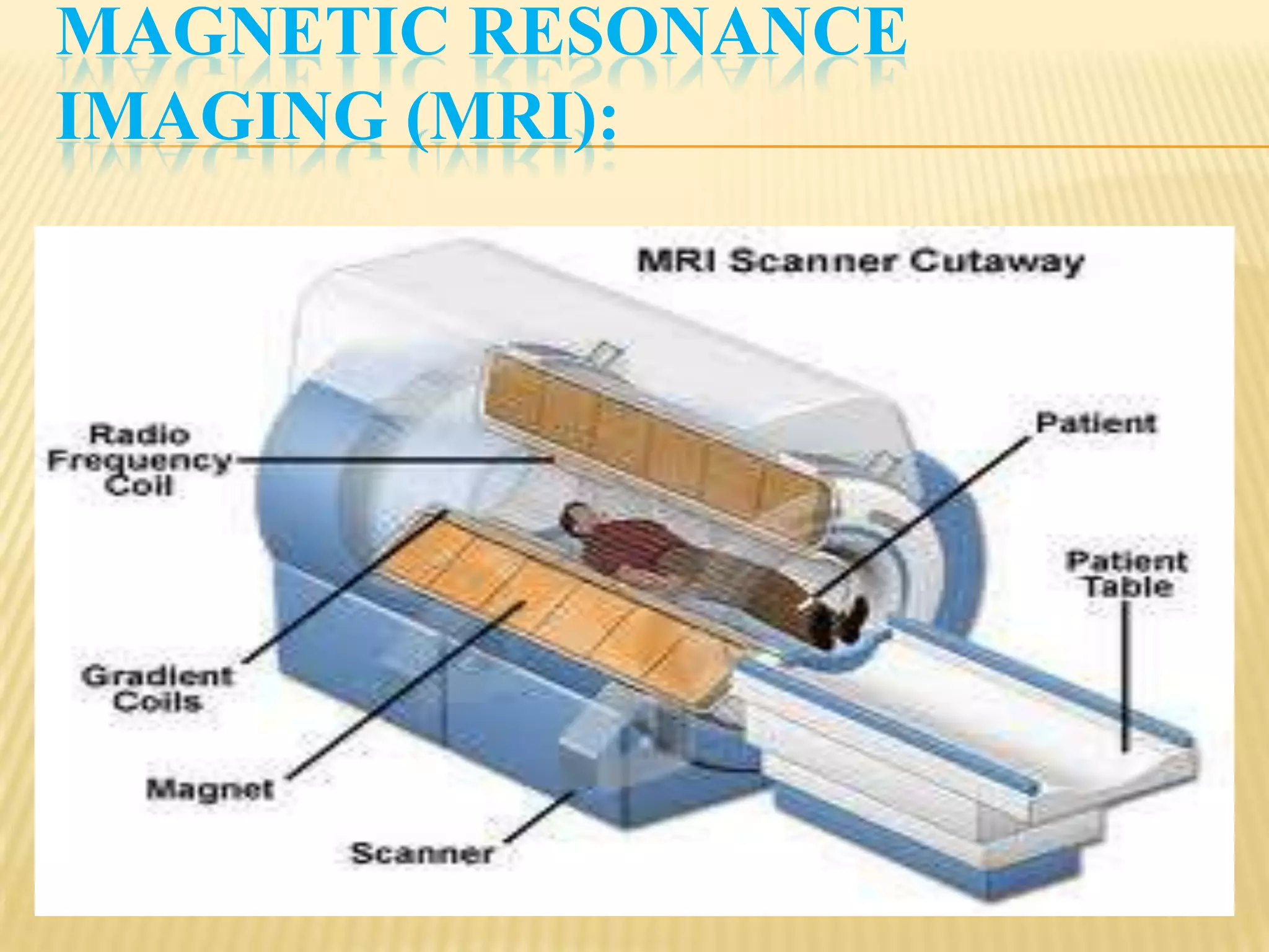 MAGNETIC RESONANCE
IMAGING (MRI):
 