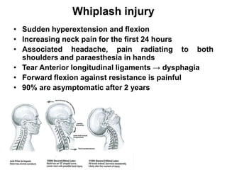 Whiplash injury
• Sudden hyperextension and flexion
• Increasing neck pain for the first 24 hours
• Associated headache, pain radiating to both
shoulders and paraesthesia in hands
• Tear Anterior longitudinal ligaments → dysphagia
• Forward flexion against resistance is painful
• 90% are asymptomatic after 2 years
 