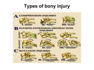 Types of bony injury
 