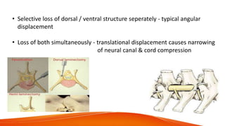 • Selective loss of dorsal / ventral structure seperately - typical angular
displacement
• Loss of both simultaneously - translational displacement causes narrowing
of neural canal & cord compression
 